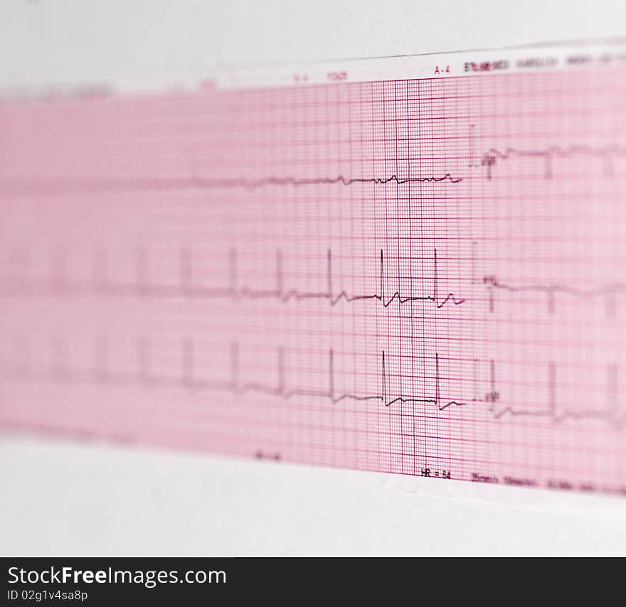 ECG printout isolated on white background