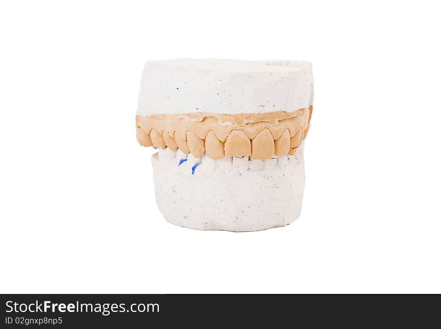 Teeth Plaster Cast. Close Up On White Background