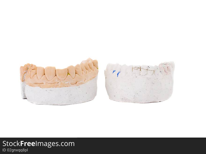 Teeth plaster cast. Close up on white background