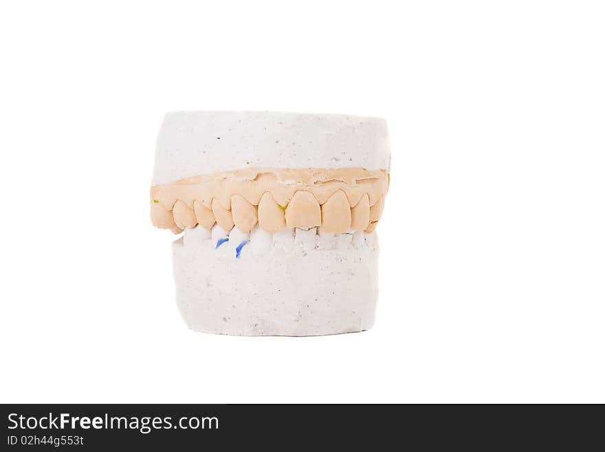 Teeth Plaster Cast. Close Up On White Background