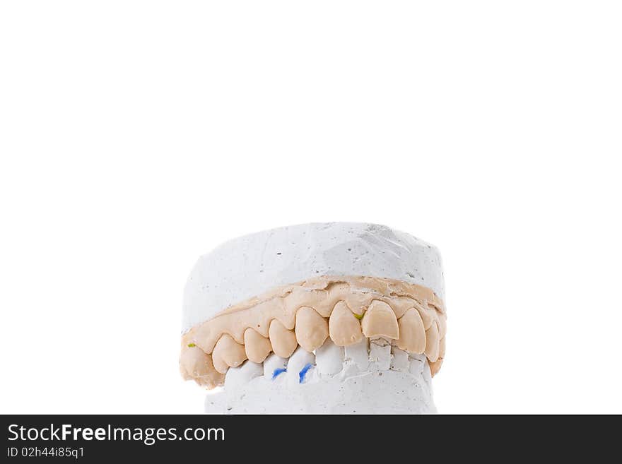 Teeth Plaster Cast. Close Up On White Background