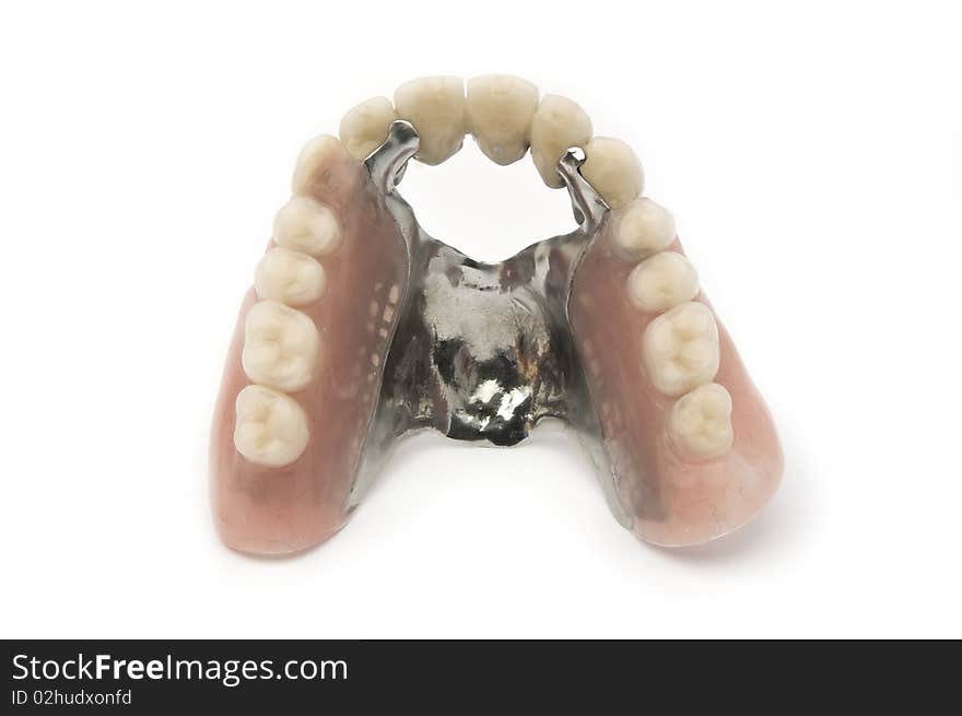 Combined fixed and mobile prosthesis with milling and micro connection