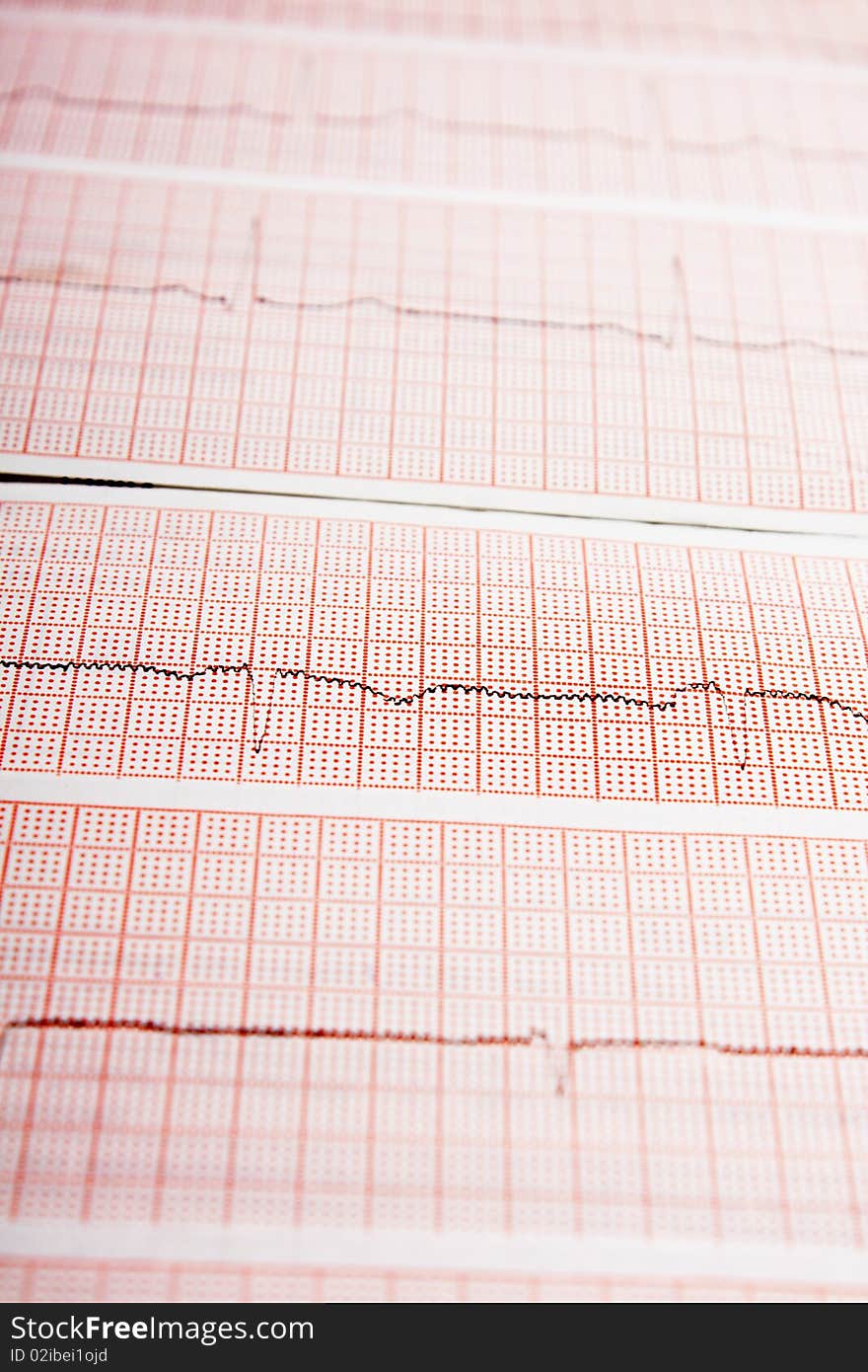 Closeup of a heart rate monitor printout. Closeup of a heart rate monitor printout