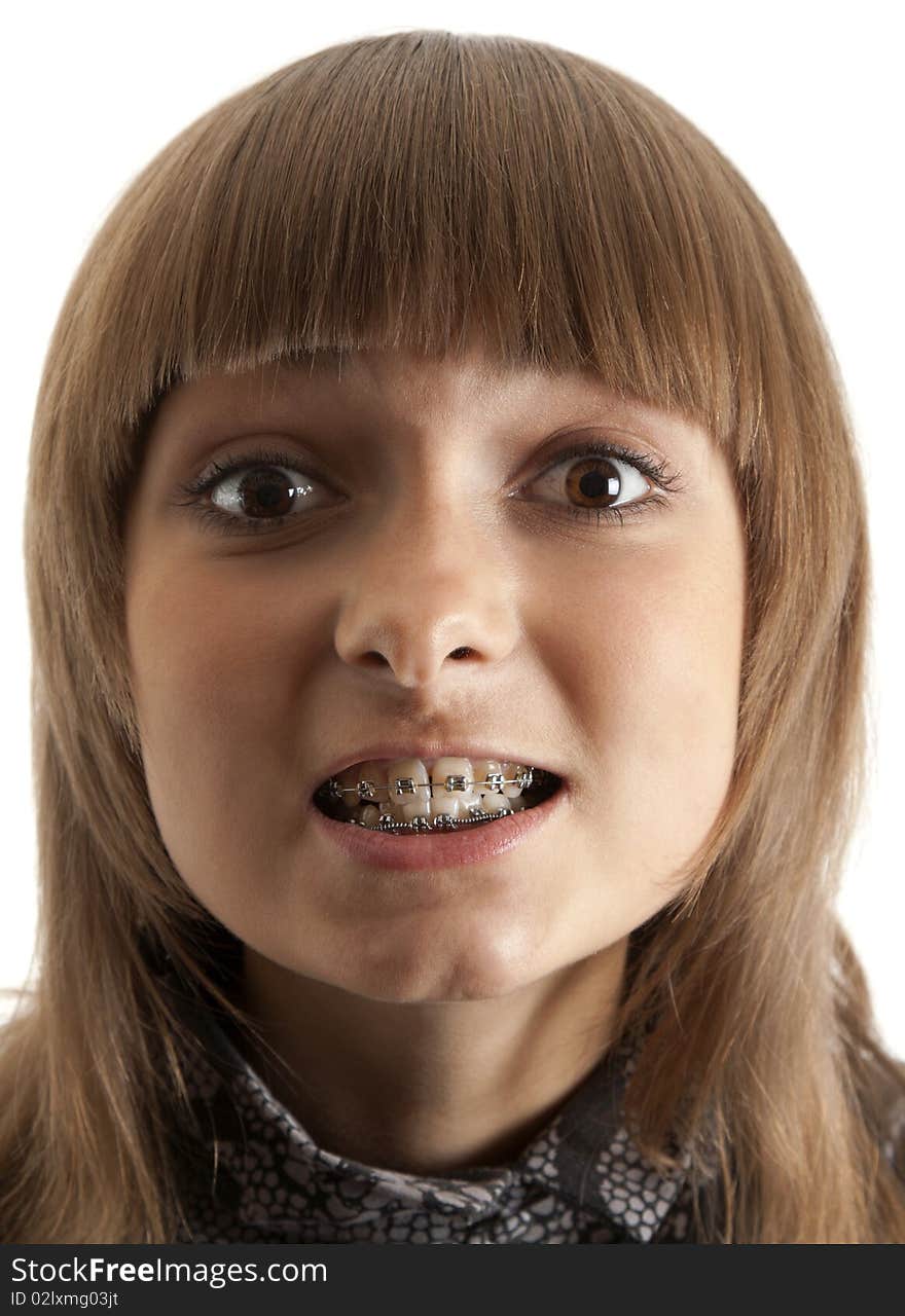 Girl smiles with bracket on teeth