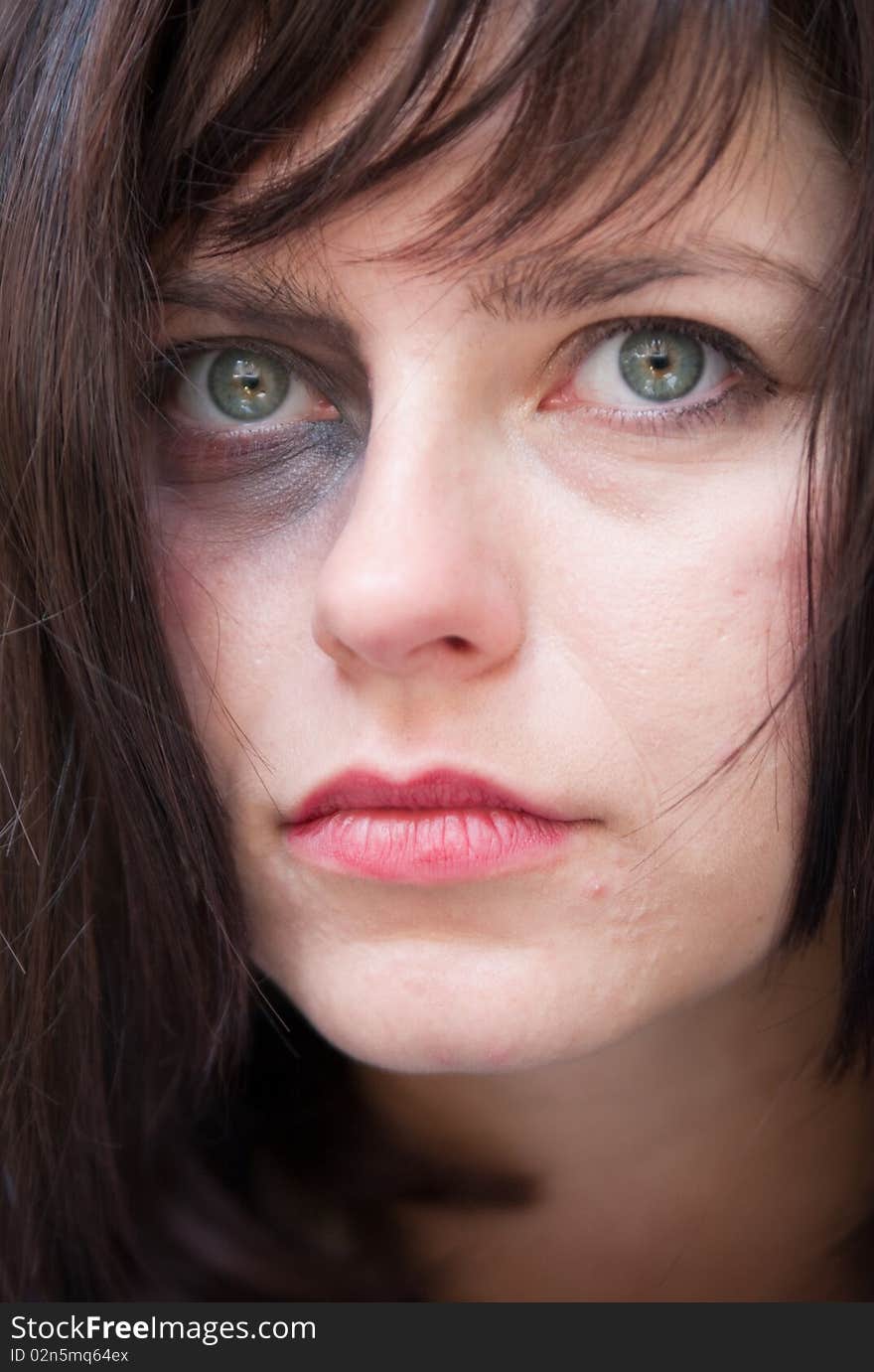 Closeup Of Young Attractive Woman With A Black Eye