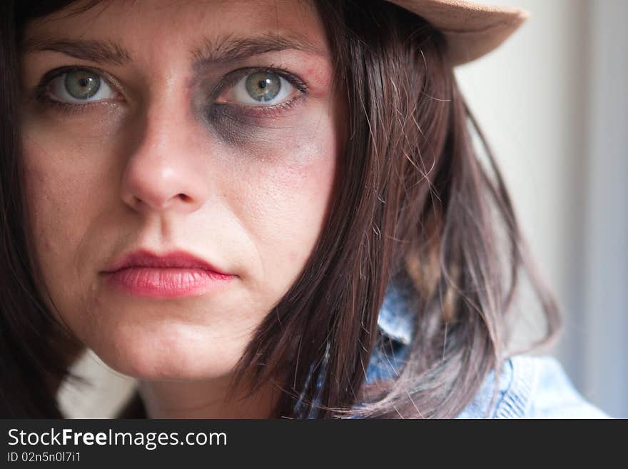 Close up of young woman face with bruised eye. Close up of young woman face with bruised eye