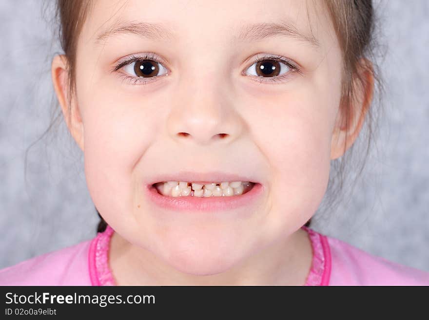 Girl grimacing, showing off his first missing milk tooth. Girl grimacing, showing off his first missing milk tooth