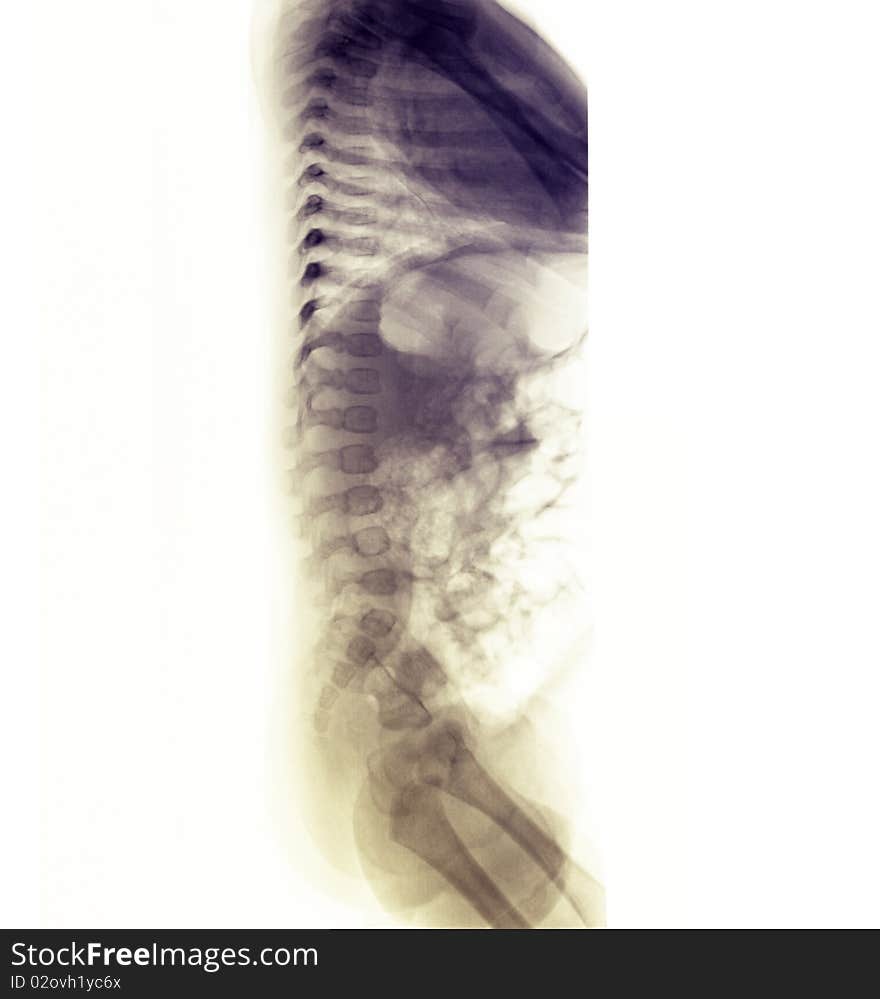 X-ray Of A 3 Month Old Female