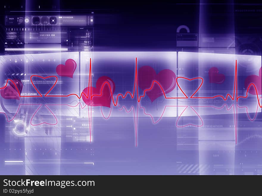 ECG