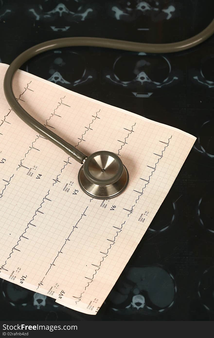 Doctor's stethoscope and chart a patient's heart. Doctor's stethoscope and chart a patient's heart