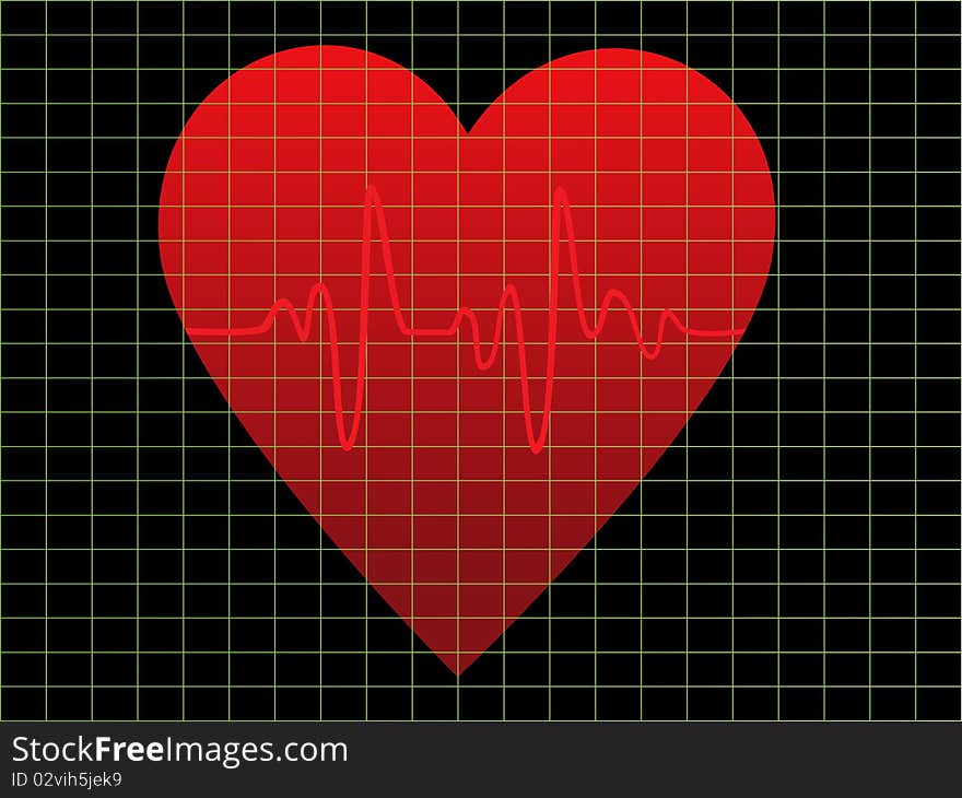 EKG or heart monitor