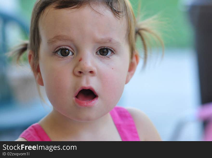 Close up of a little girl with a scratch on her nose. Close up of a little girl with a scratch on her nose