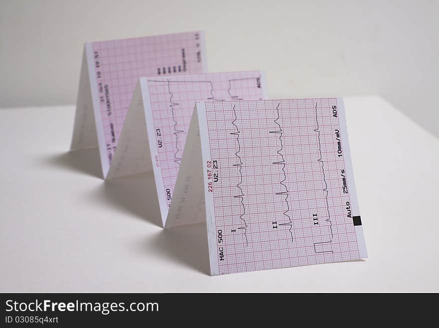 Photo of real electrocardiogram graph