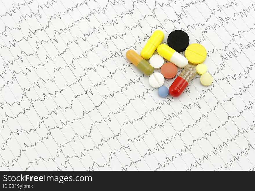 Tablets On The Electrocardiogram.