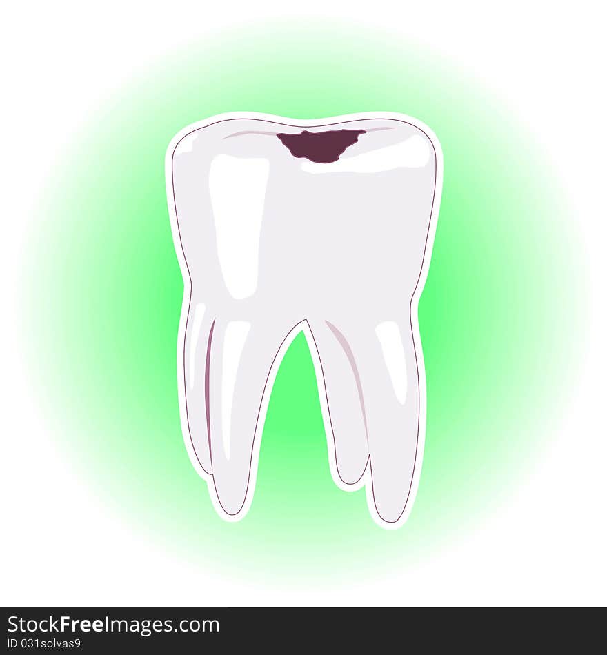 Tooth with cavity or dental filling illustration isolated on white green background