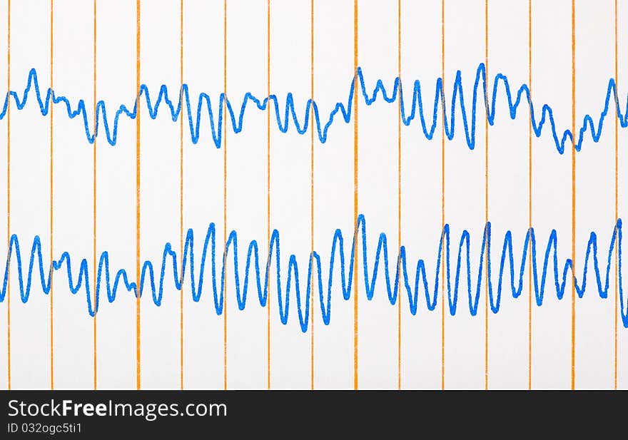 Electro cardiogram ecg - medical background. Electro cardiogram ecg - medical background