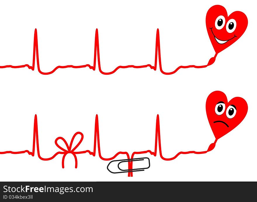 Cardiogram