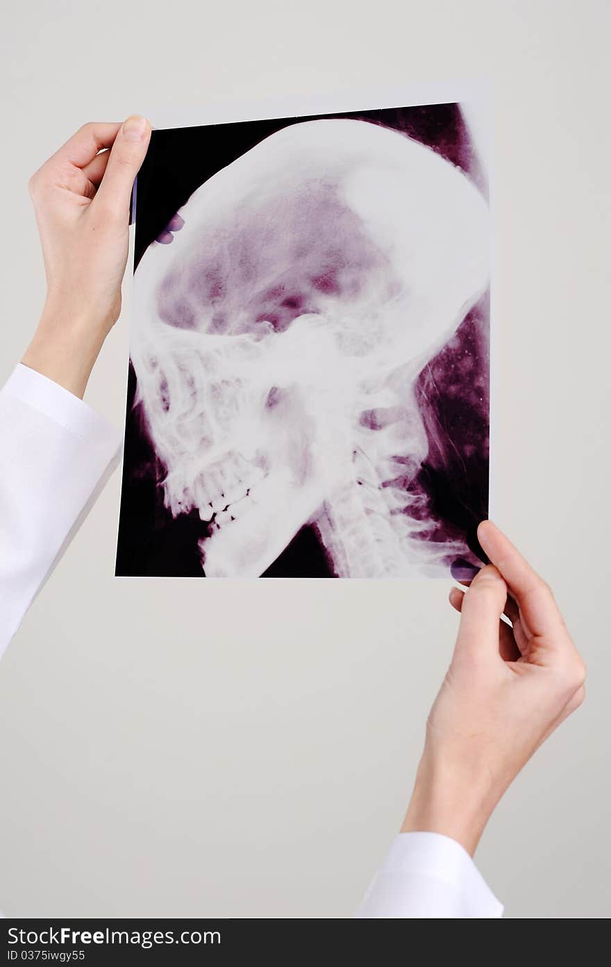 An image of womans hands holding x-ray. An image of womans hands holding x-ray