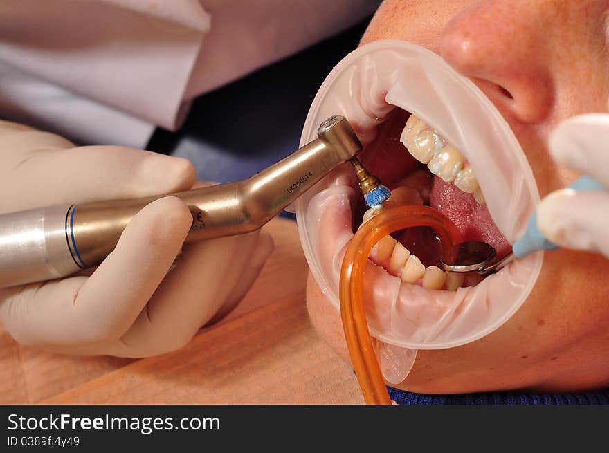 Photo of patient having his teeth healed. Photo of patient having his teeth healed.