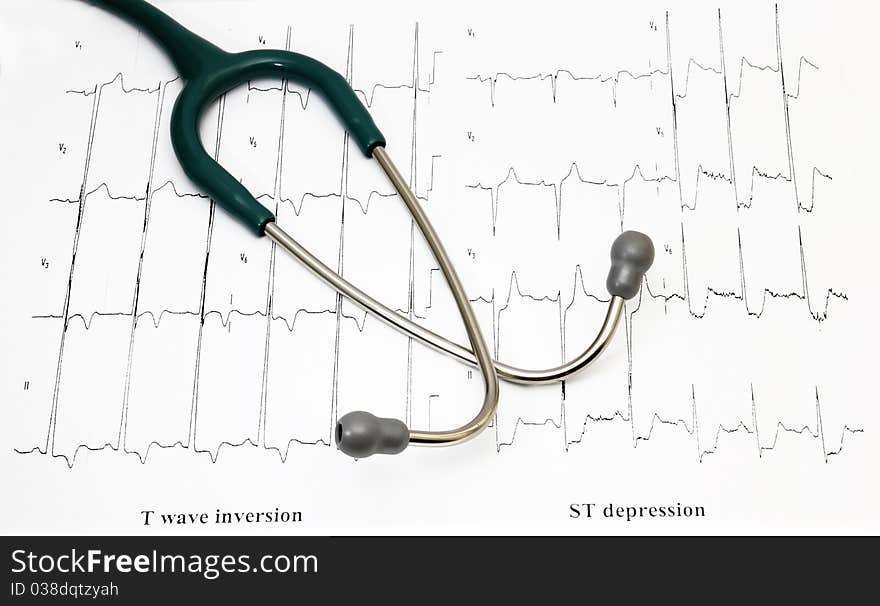 Blue stethoscope on EKG. background