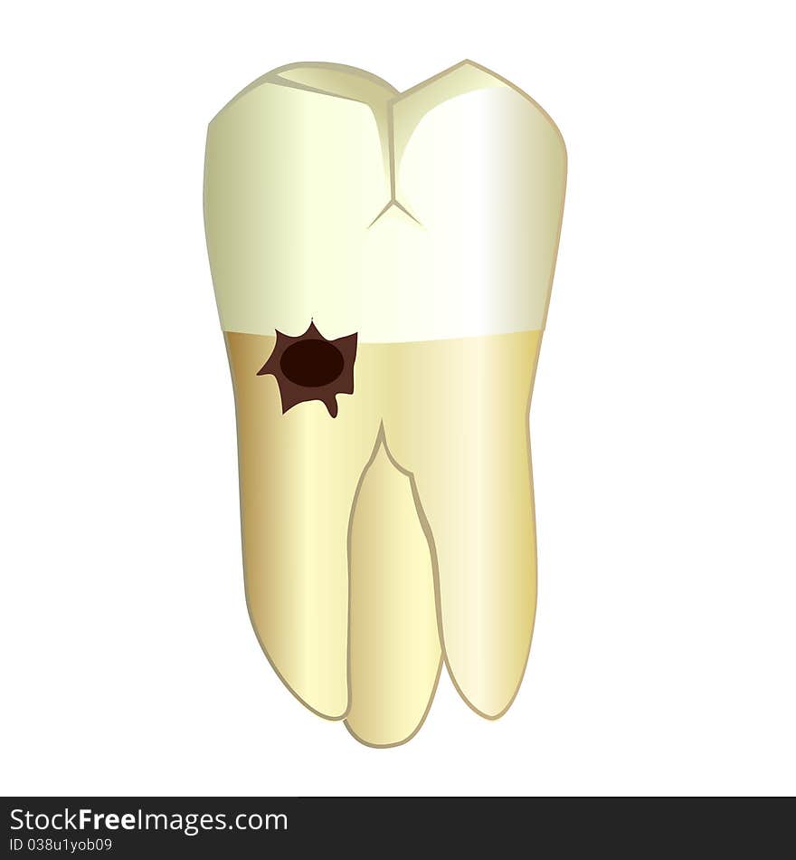 Tooth With A Root