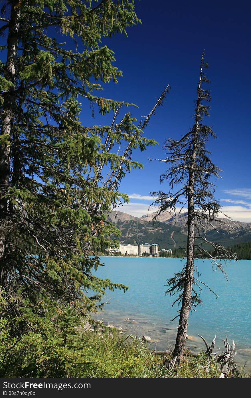 A view of Lake Louise on a sunny September day.