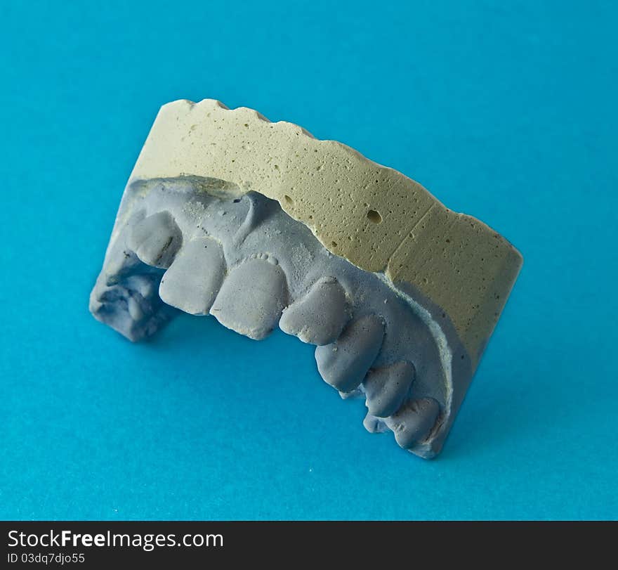 Plaster model of teeth on a blue background. Plaster model of teeth on a blue background