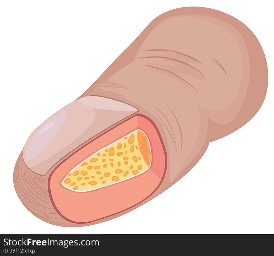 Human finger cross-section illustration on white background