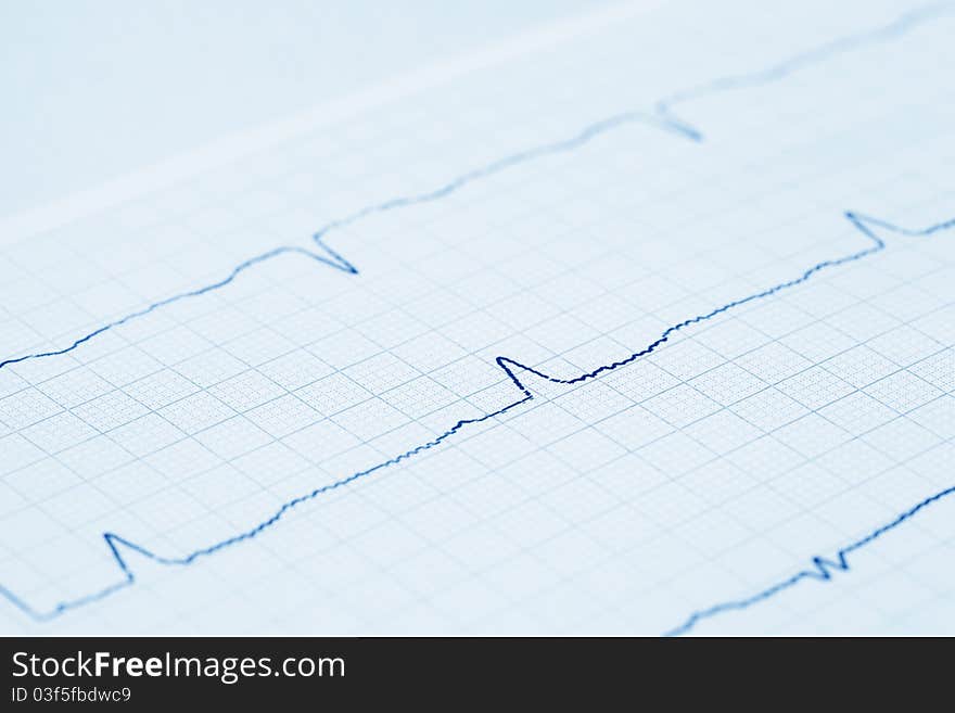 Close-up view on cardiogram. Medical abstract still-life. Blue toned. Close-up view on cardiogram. Medical abstract still-life. Blue toned