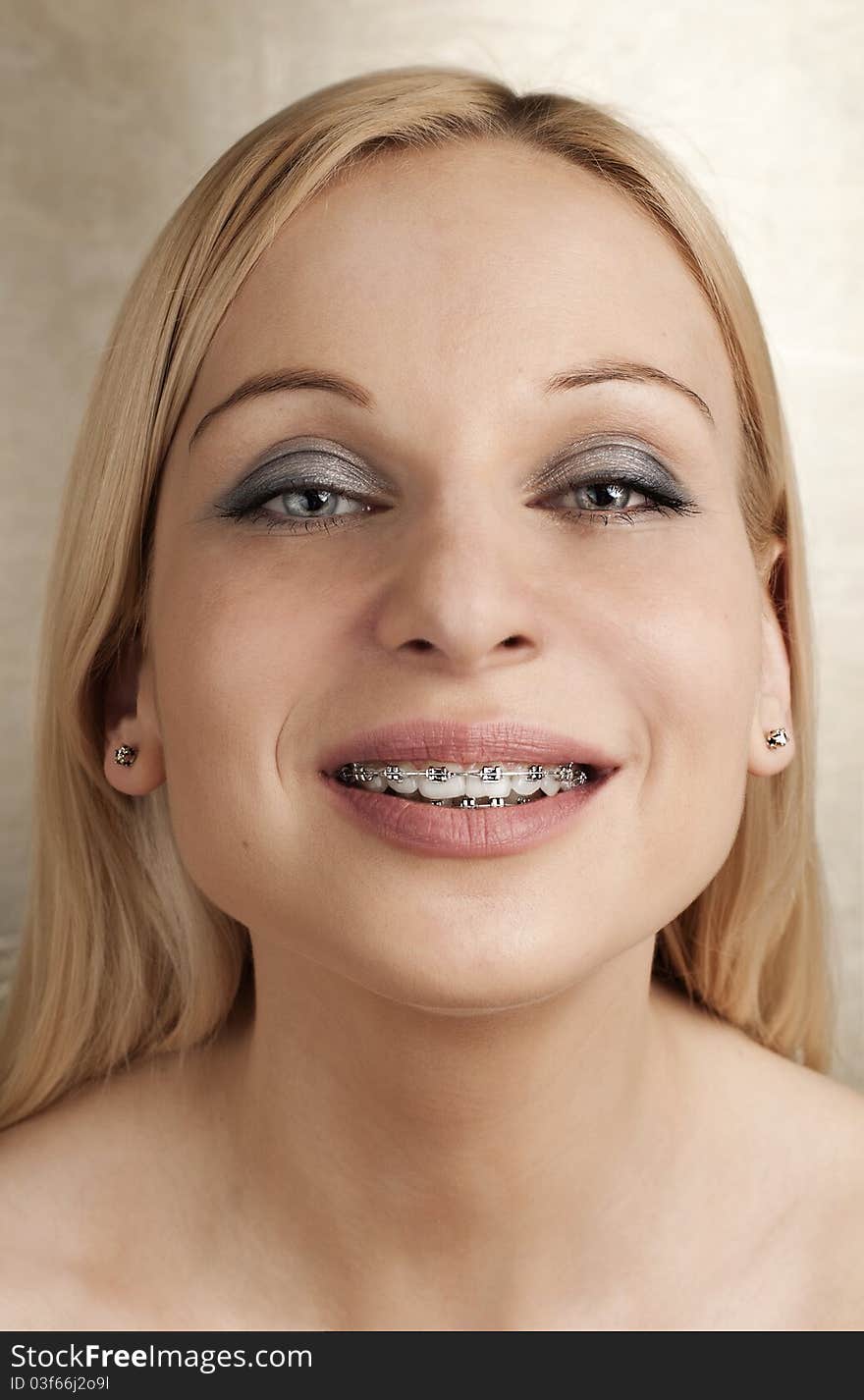 Woman with braces on a golden background