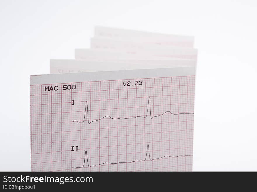 Photo of real electrocardiogram graph