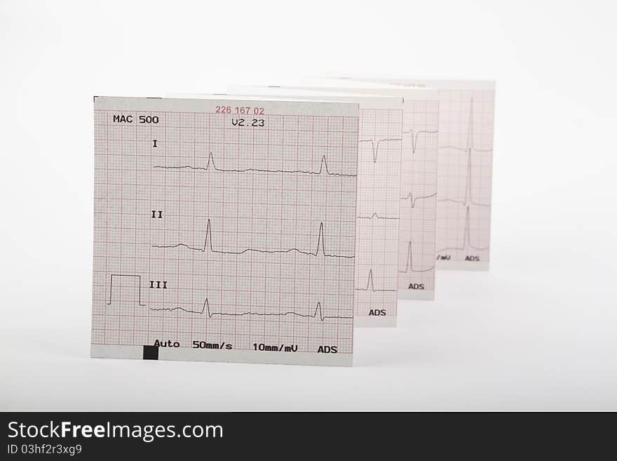 Photo of real electrocardiogram graph