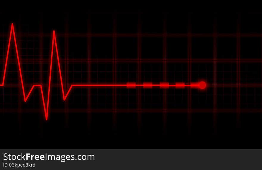 ECG Electrocardiogram