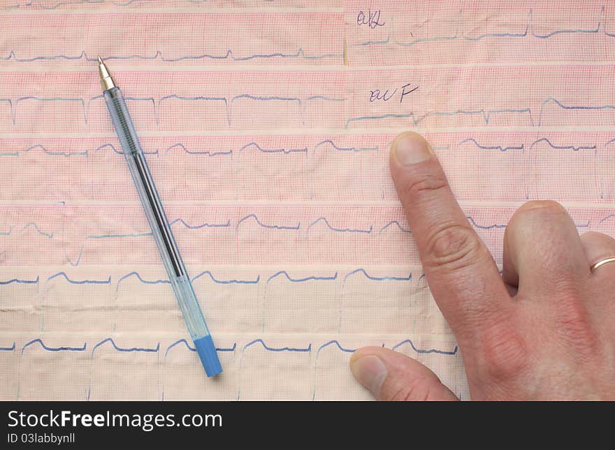 Indicate An Element Of ECG