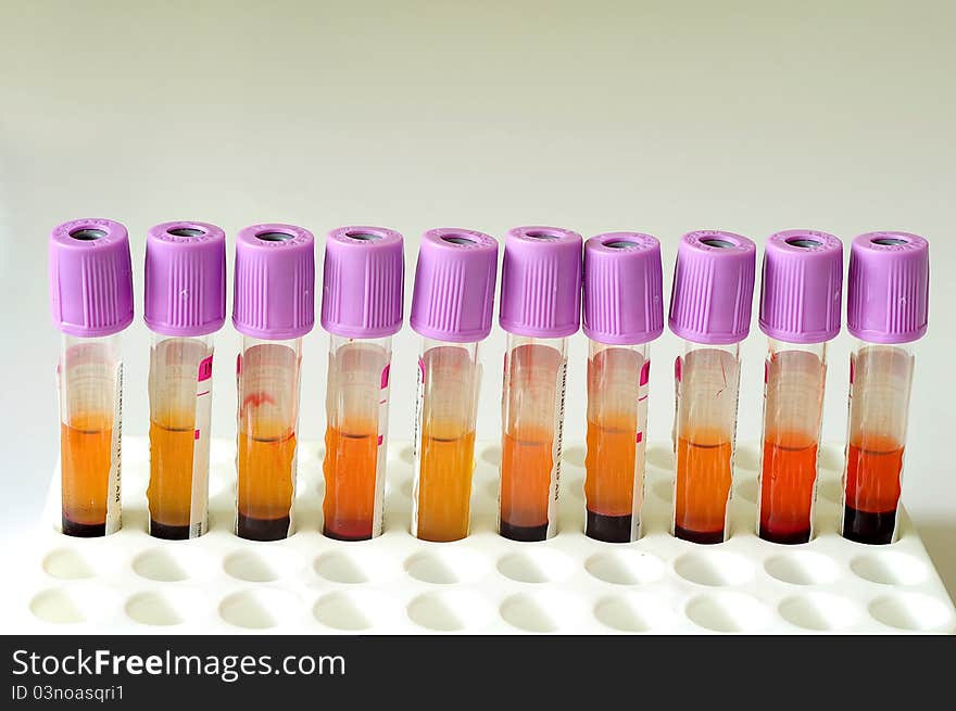 A row of blood sample with purple cap