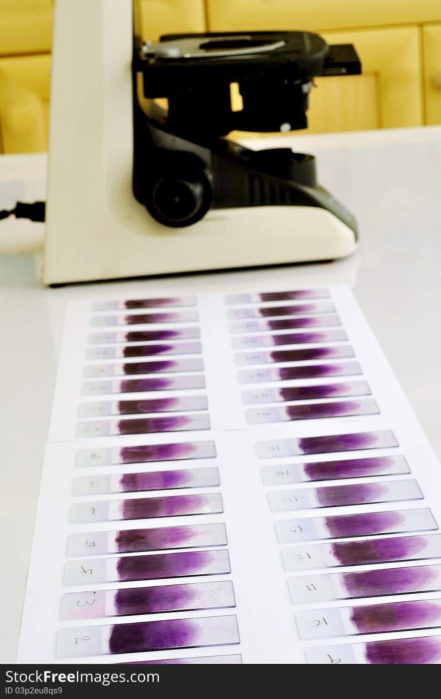 A Blood film waiting for analysis by microscope