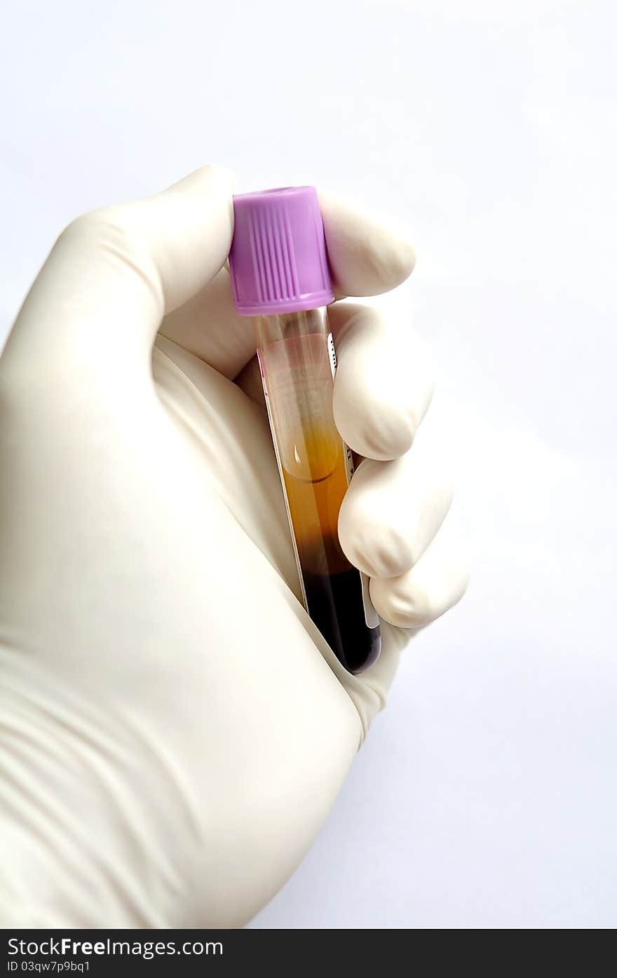 A medical technician holding a blood sample