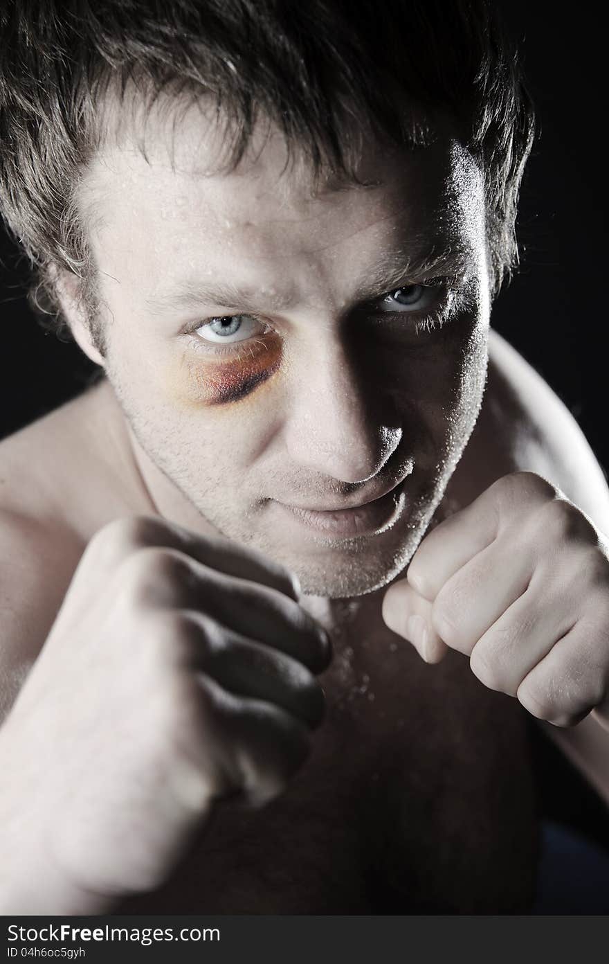 Portrait of a man with a bruise in a battle position. Clenched fists. Dark background. Portrait of a man with a bruise in a battle position. Clenched fists. Dark background.