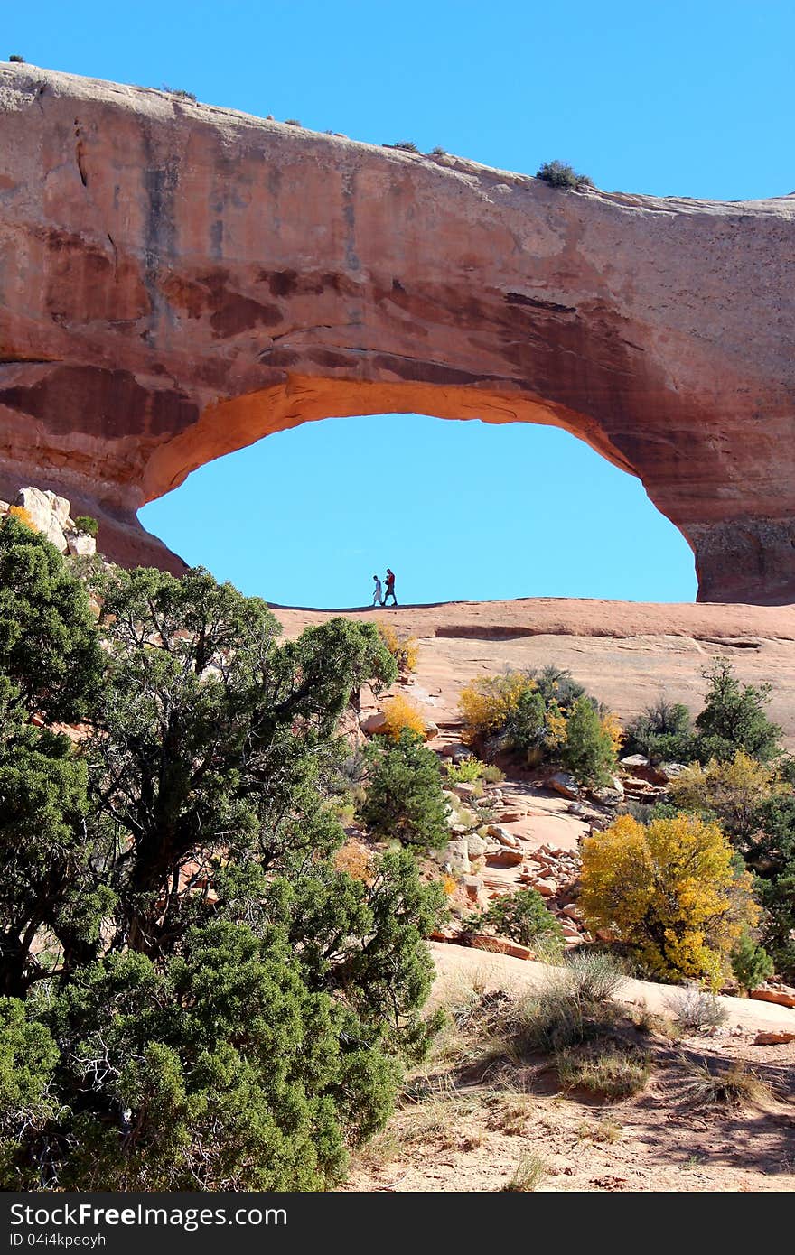 Wilson arch vertical