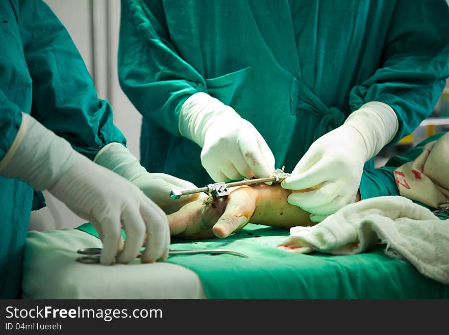 Close up of nurse hands during surgery in operation room. Close up of nurse hands during surgery in operation room