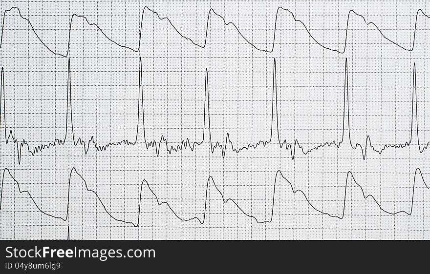 Cardiogram