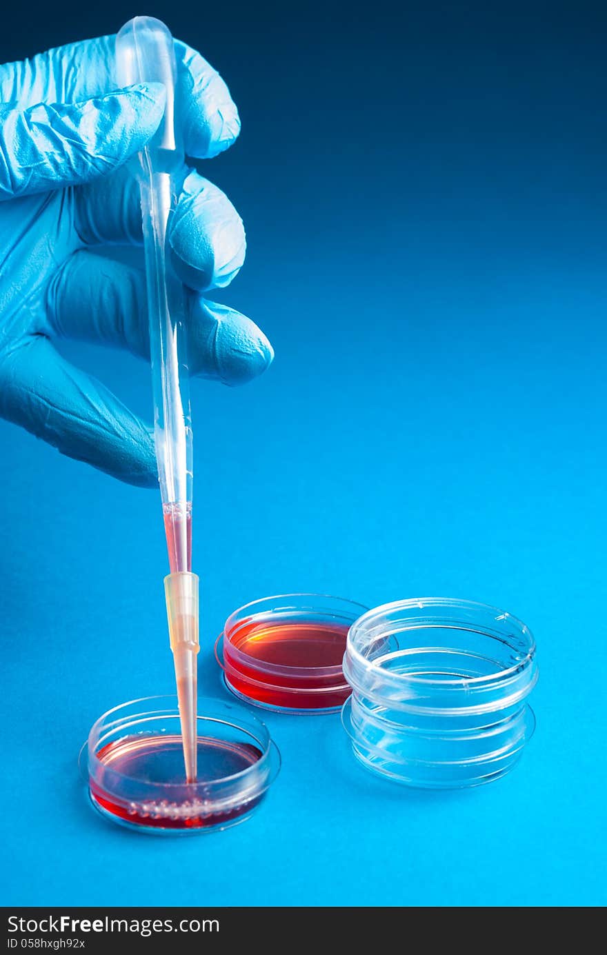 Biochemistry of blood tests. Cell culture for the biomedical diagnostic. Gloved hand hold the pipette with petri dish for blood analysis. Plastic labware for scientific research. Biochemistry of blood tests. Cell culture for the biomedical diagnostic. Gloved hand hold the pipette with petri dish for blood analysis. Plastic labware for scientific research.