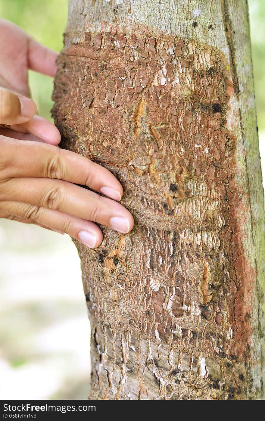 Natural rubber Disease with hand