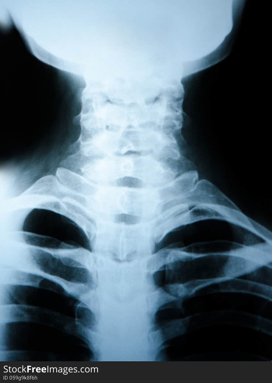 X-ray scan of neck