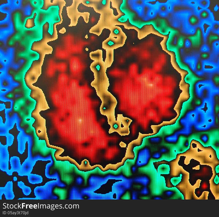 Heart Ejection Fraction   Imaging