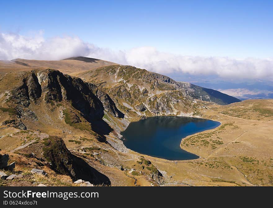 Lakes Bulgaria-kidney