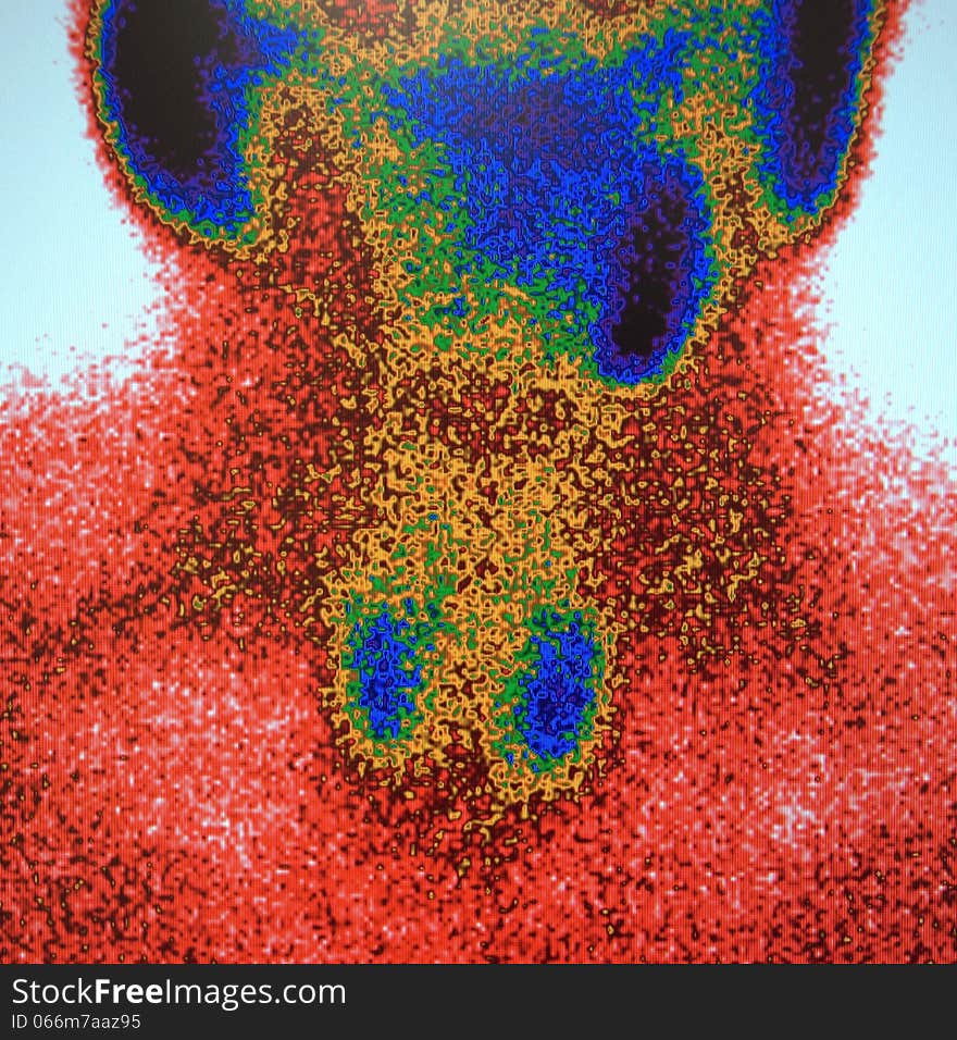 Salivary glands  ,nuclear scan