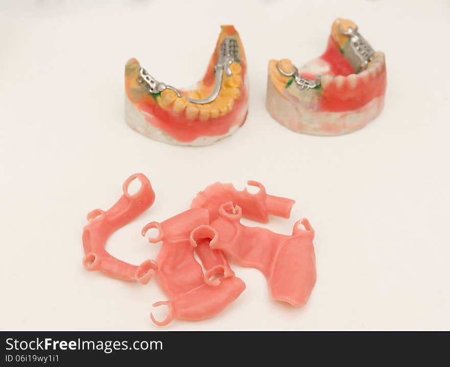 Denture clasp on one of the stages of manufacturing in the dental laboratory. Denture clasp on one of the stages of manufacturing in the dental laboratory