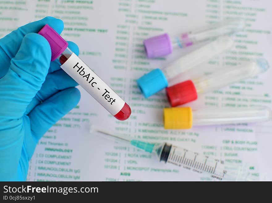 Blood sample for hemoglobin A1c test, diabetes diagnosis. Blood sample for hemoglobin A1c test, diabetes diagnosis