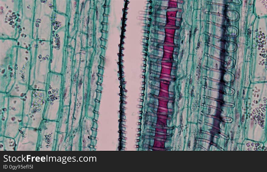 long section: Cucurbita stem magnification: 400x Bicollateral vascular bundles have two zones of phloem and two zones of cambium on either side of the central xylem with outer facing tissues more heavily developed. The sequence of tissues in the bicollateral vascular bundle is outer phloem, outer cambium, xylem, inner cambium and inner phloem with outer more heavily developed. Walls of xylem vessels have lignin free pits and lignin thickenings that form rings, spirals, networks and solid blocks. Between the xylem and phloem are a few regularly arranged layers of elongated cambium cells. long section: Cucurbita stem magnification: 400x Bicollateral vascular bundles have two zones of phloem and two zones of cambium on either side of the central xylem with outer facing tissues more heavily developed. The sequence of tissues in the bicollateral vascular bundle is outer phloem, outer cambium, xylem, inner cambium and inner phloem with outer more heavily developed. Walls of xylem vessels have lignin free pits and lignin thickenings that form rings, spirals, networks and solid blocks. Between the xylem and phloem are a few regularly arranged layers of elongated cambium cells.